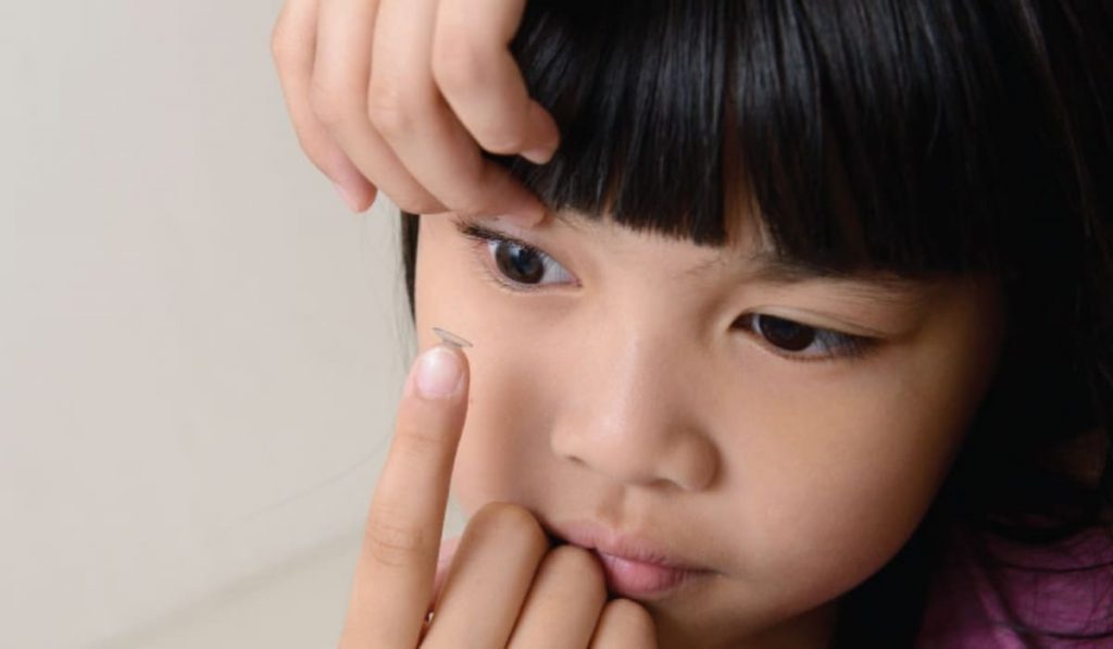 Kính áp tròng Ortho-K đeo ban đêm giúp định hình giác mạc, kiểm soát tiến triển cận thị