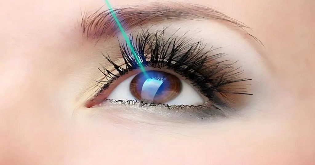 Chọn sai phương pháp phẫu thuật khiến thị lực sau mổ có thể không bền vững