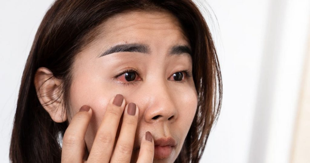 Không bảo vệ tốt mắt dễ dẫn đến tình trạng bị nhiễm trùng mắt