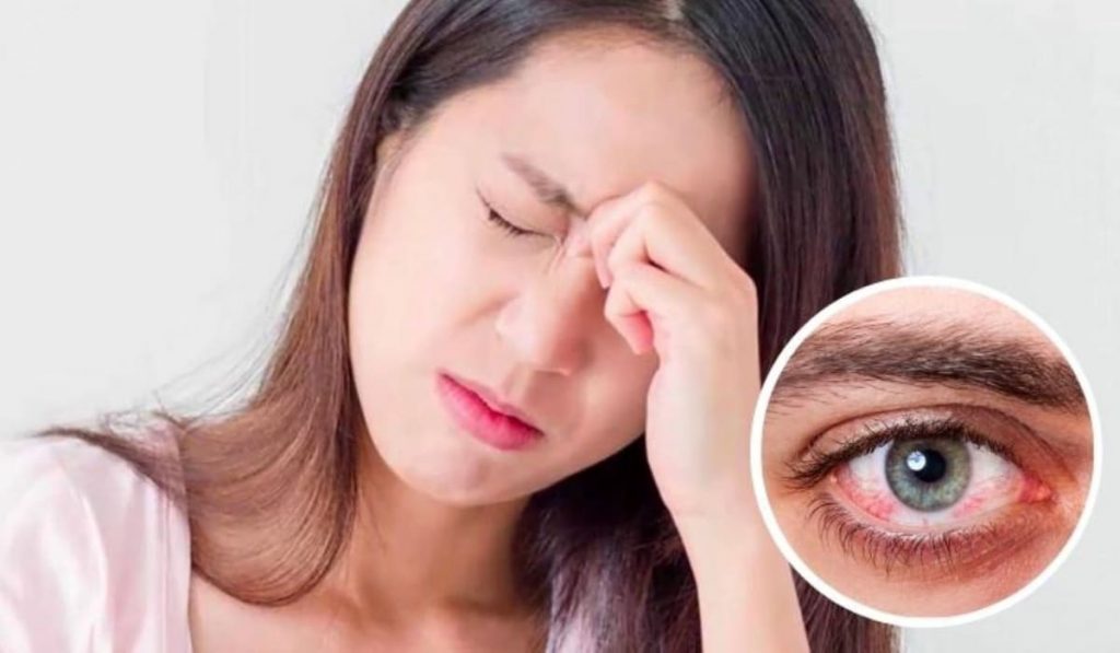 Nếu thấy mắt đỏ bất thường, nên đi khám càng sớm càng tốt