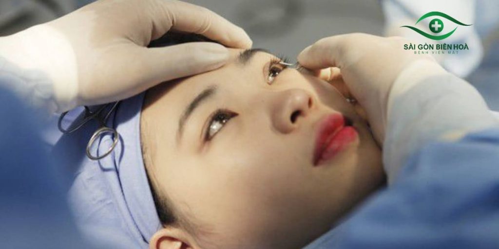Người bệnh không đau và hoàn toàn tỉnh táo trong quá trình mổ cận thị