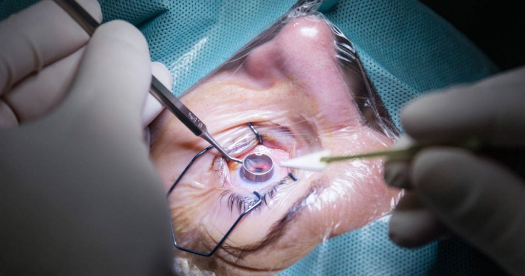 Phẫu thuật bằng laser có độ an toàn, tỷ lệ thành công cao và khả năng phục hồi nhanh