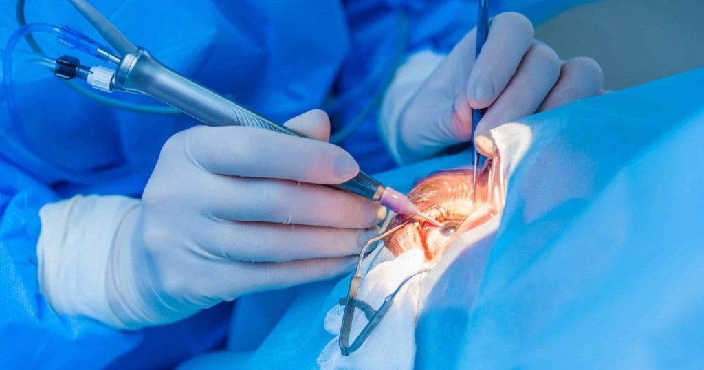 Phẫu thuật là phương pháp điều trị hiệu quả nhất