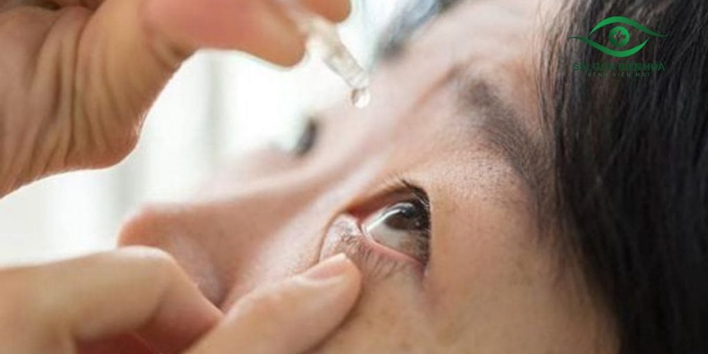 Thuốc nhỏ mắt có thể cải thiện thoát lưu thuỷ dịch, giảm nhãn áp