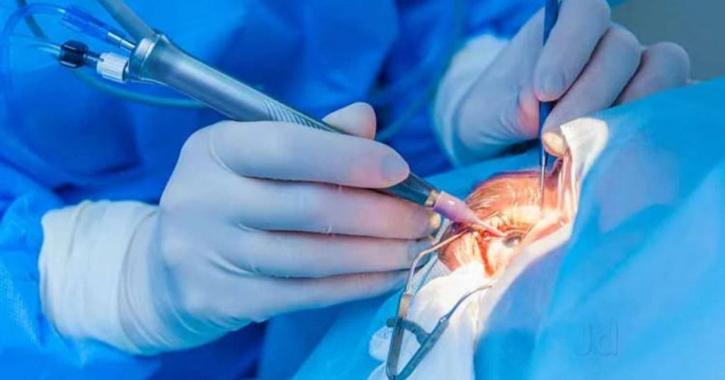 Bạn có thể được điều trị võng mạc bị bong bằng Laser quang đông võng mạc