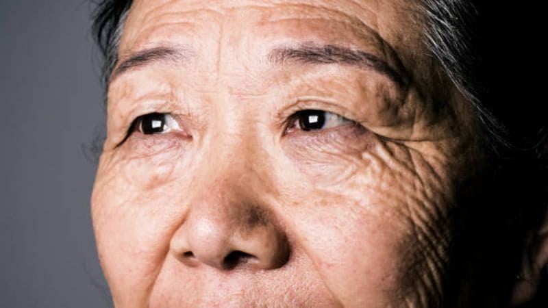 Bệnh nhân có thể nhìn rõ kể từ 1 tháng sau phẫu thuật