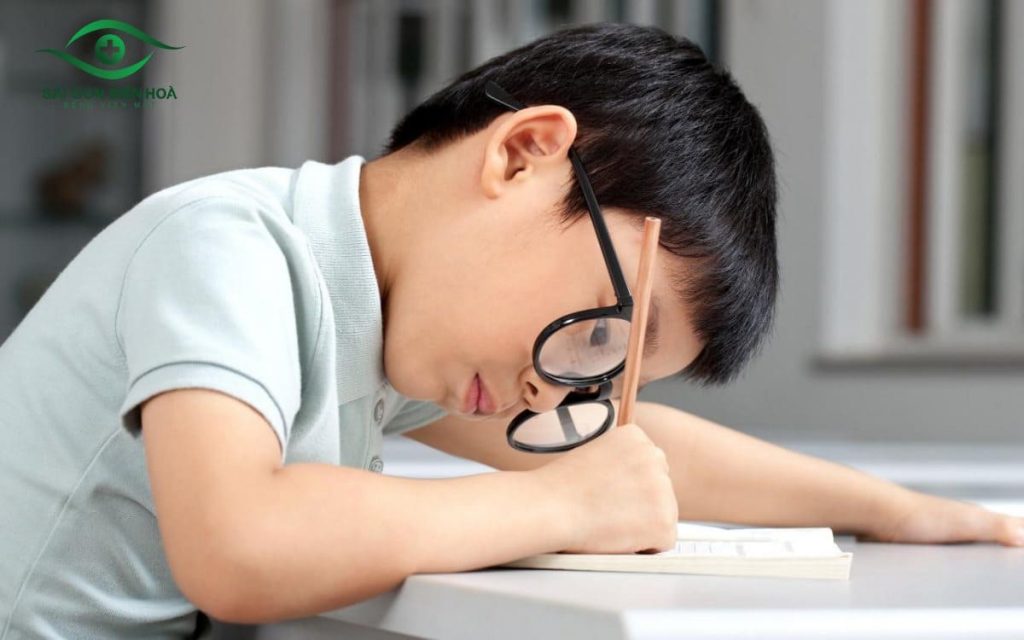 Cận thị nặng là một trong những nguyên nhân gây bong võng mạc