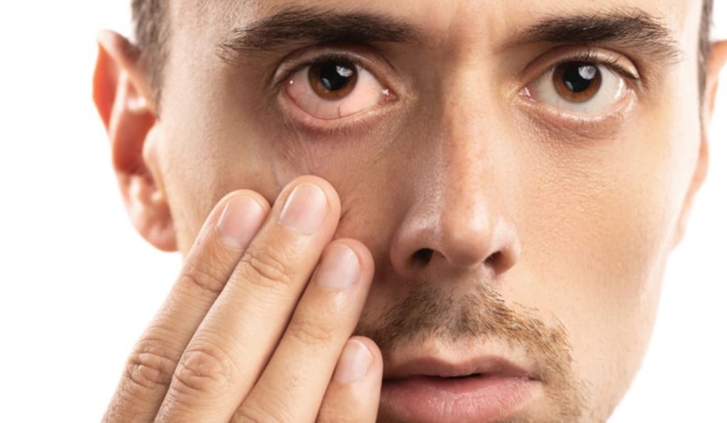 Chăm sóc mắt: 20-20-20, giữ khoảng cách, chỉnh sáng để giảm nháy mắt phải nam