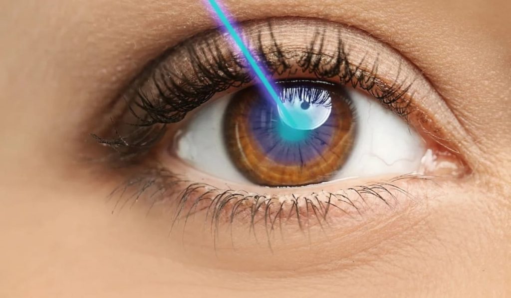 Hình ảnh minh họa tia Femtosecond Laser