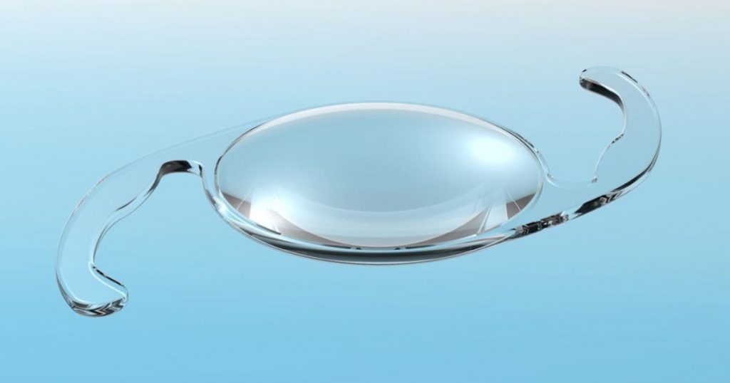 IOL là loại thấu kính nội nhãn có tuổi thọ vĩnh viễn