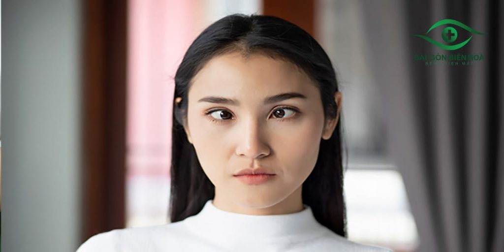 Mắt lé ảnh hưởng trực tiếp đến vấn đề thẩm mỹ