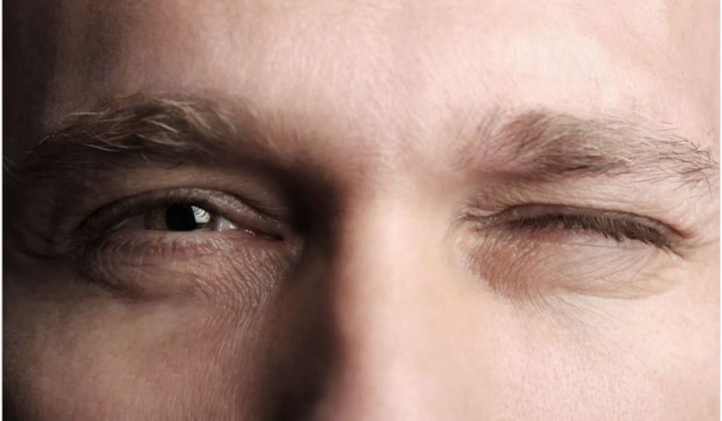 Nháy mắt trái nam theo giờ thường do mệt mỏi, stress, thiếu ngủ hoặc bệnh lý mắt