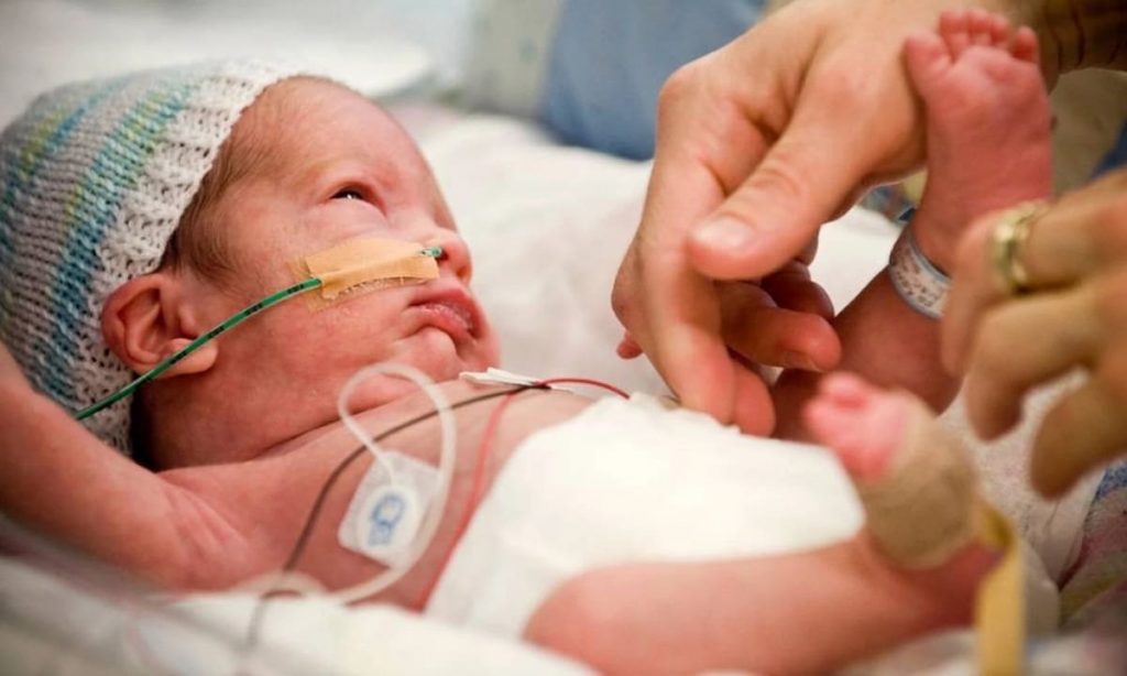 Quy trình xét nghiệm & chẩn đoán bong võng mạc ở trẻ sinh non gồm 3 bước