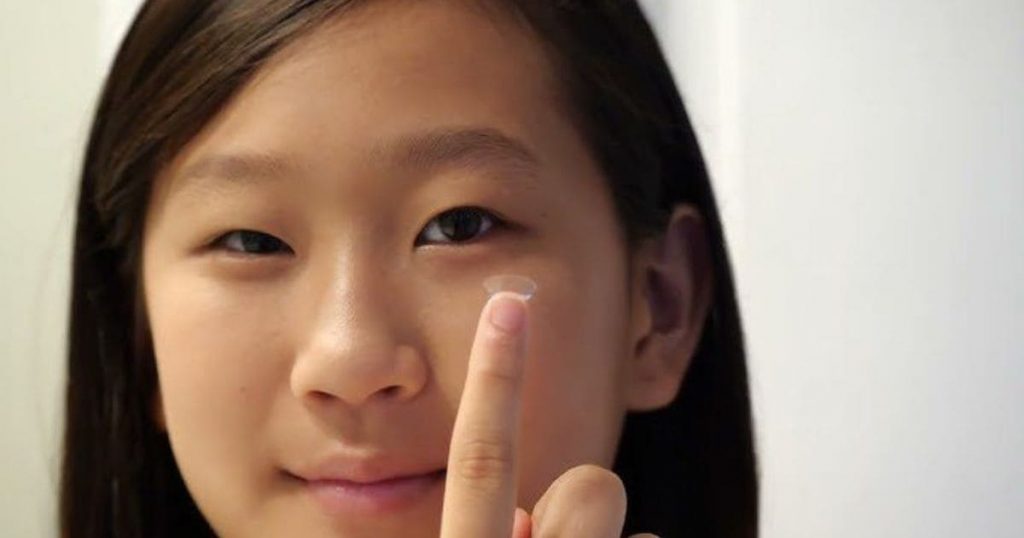 Thay vì đeo kính, trẻ bị loạn thị có thể đeo kính áp tròng Ortho K