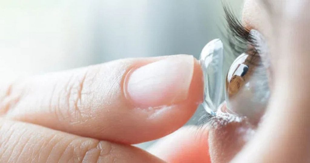 Bạn không nên đeo lens khi chưa được bác sĩ cho phép