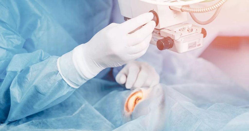 Các bác sĩ sẽ tán nhuyễn thuỷ tinh thể cũ trước, sau đó mới hút từng mảnh ra ngoài