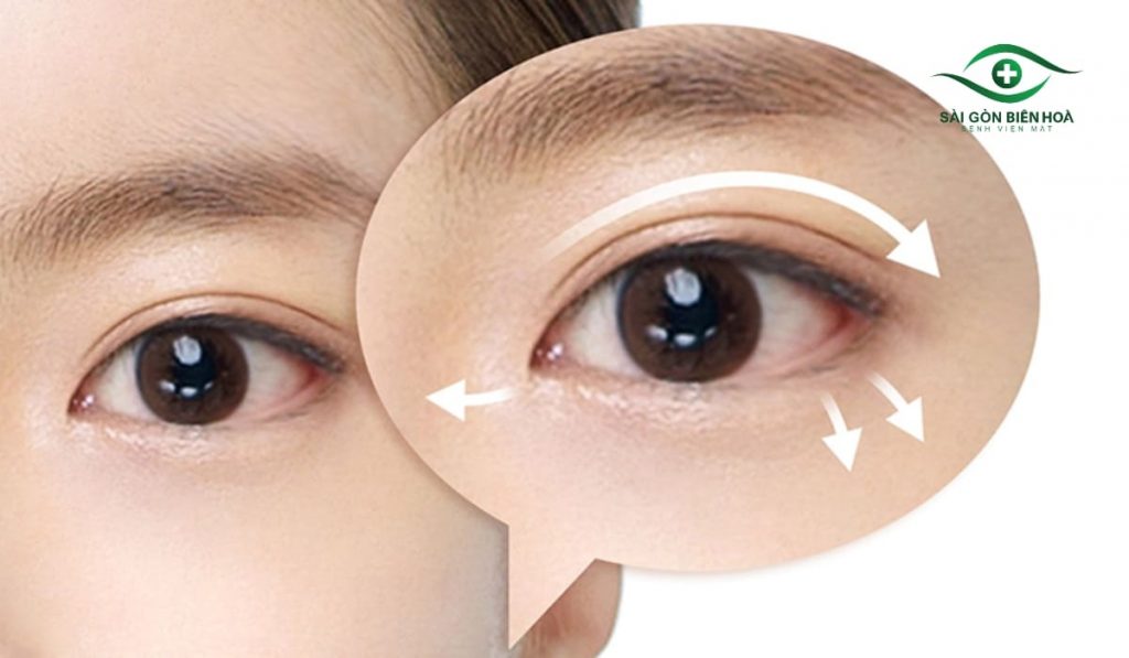 Cắt mí loại bỏ da dư, mỡ thừa, tạo mắt to, rõ nét. Hồi phục 1-2 tuần