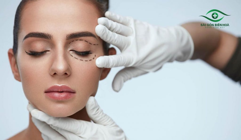 Cắt mí mắt loại bỏ da chùng, mỡ thừa, tạo nếp mí giúp mắt to và gương mặt trẻ trung