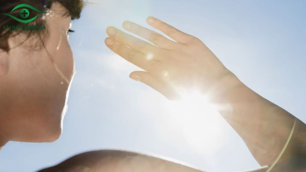 Chói mắt, nhạy cảm với ánh sáng là một trong những biểu hiện của đục bao sau