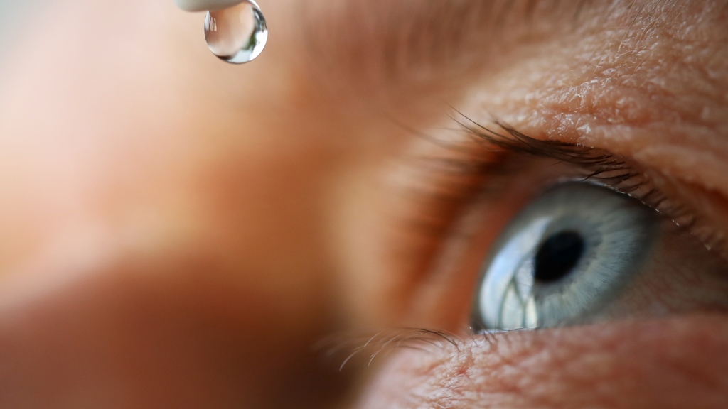 Khô mắt kéo dài là tình trạng dễ gặp sau khi tái mổ cận