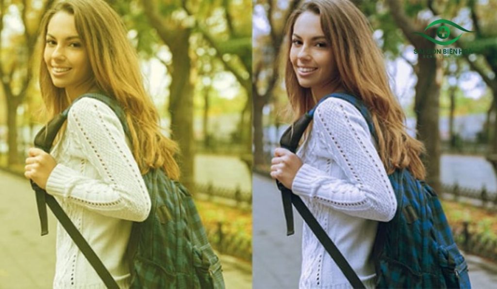 Mắt nhìn thấy màu vàng có thể là dấu hiệu bệnh lý về thủy tinh thể, võng mạc hoặc dây thần kinh thị giác