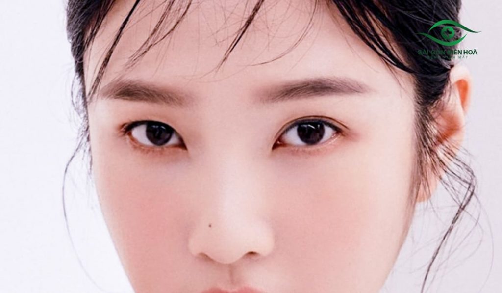 Mắt nổ mắt xịt ảnh hưởng thị lực, làm mặt mất cân đối và giảm tự tin