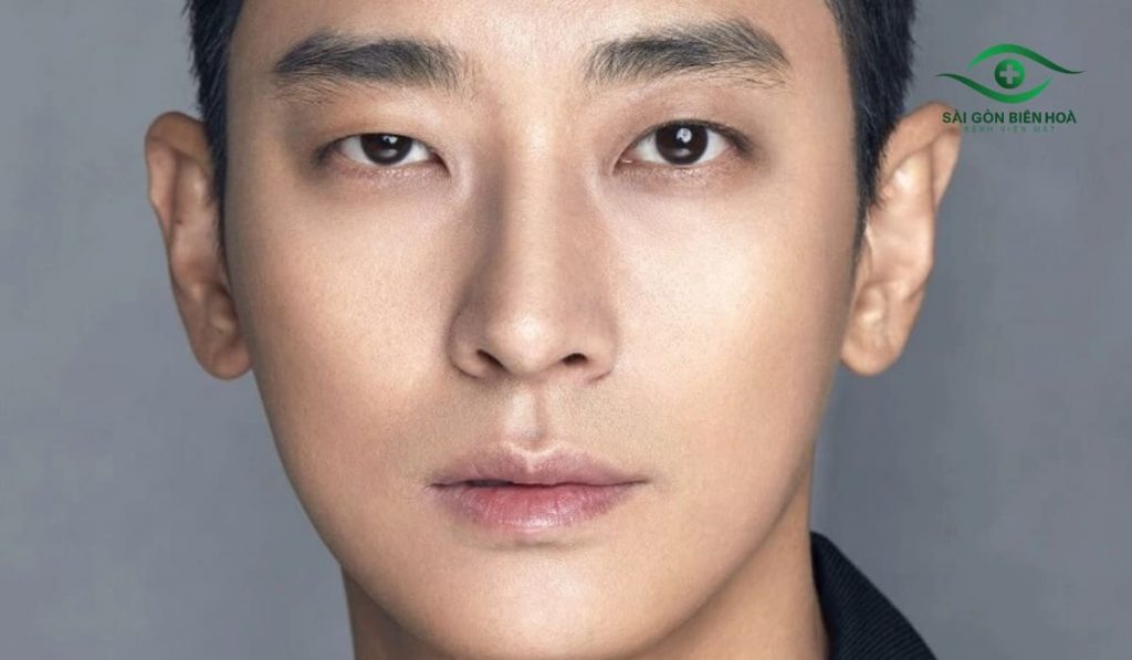 Mắt nổ mắt xịt là khi hai mắt không đều, một bên to rõ mí, bên còn lại nhỏ hoặc sụp mí