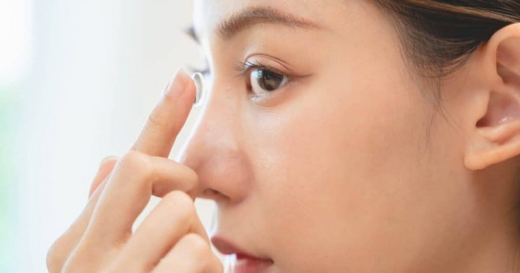 Ngoài đeo kính gọng, người bị cận thị chưa đến 18 tuổi có thể chọn đeo kính áp tròng