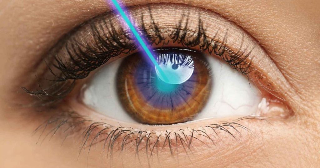 Bạn có thể được điều trị bằng cách chiếu tia Laser