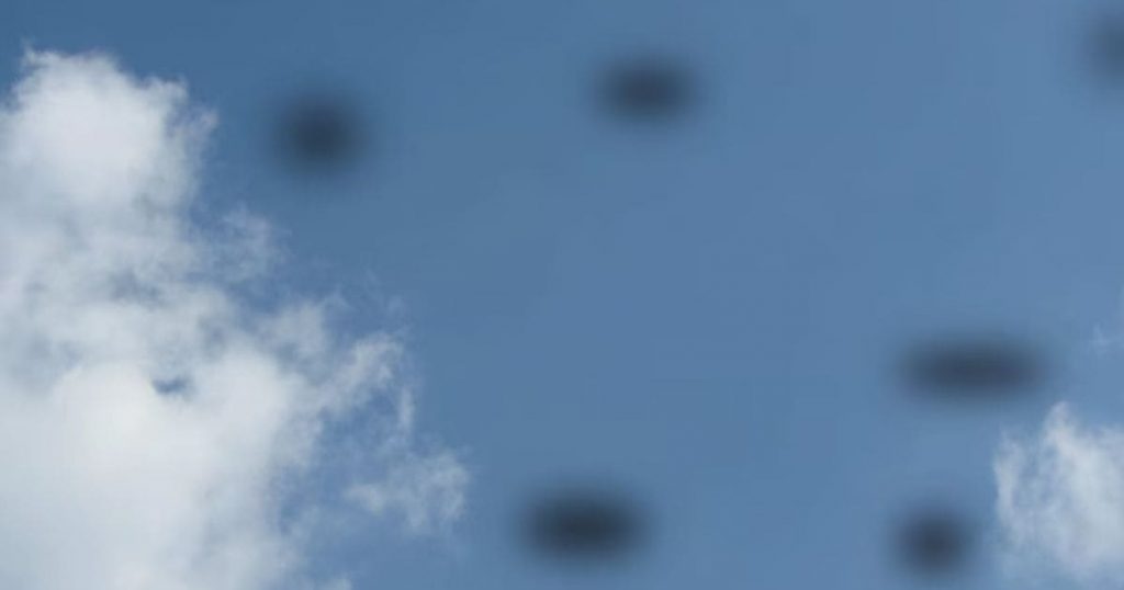 Bạn có thể vẫn nhìn thấy những đốm đen lơ lửng trước mặt nếu đã có biểu hiện này trước khi chiếu laser