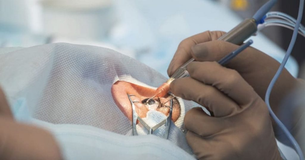 Bệnh nhân có thể lựa chọn phẫu thuật điều trị đục thuỷ tinh thể bằng Laser