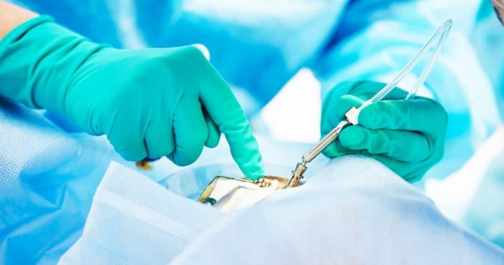 Bệnh nhân sẽ phải phẫu thuật nếu đã xuất hiện biến chứng bong võng mạc