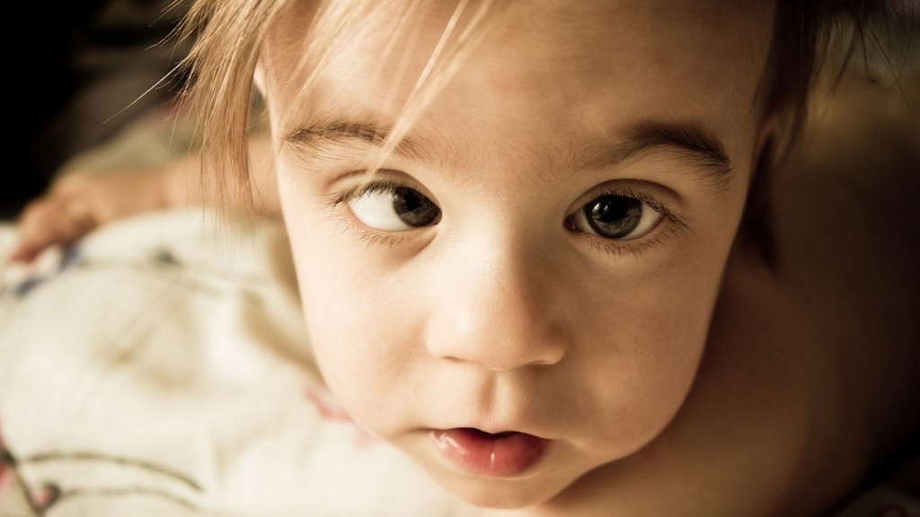 Mắt lác bẩm sinh có thể cải thiện đáng kể với tỉ lệ phục hồi cao