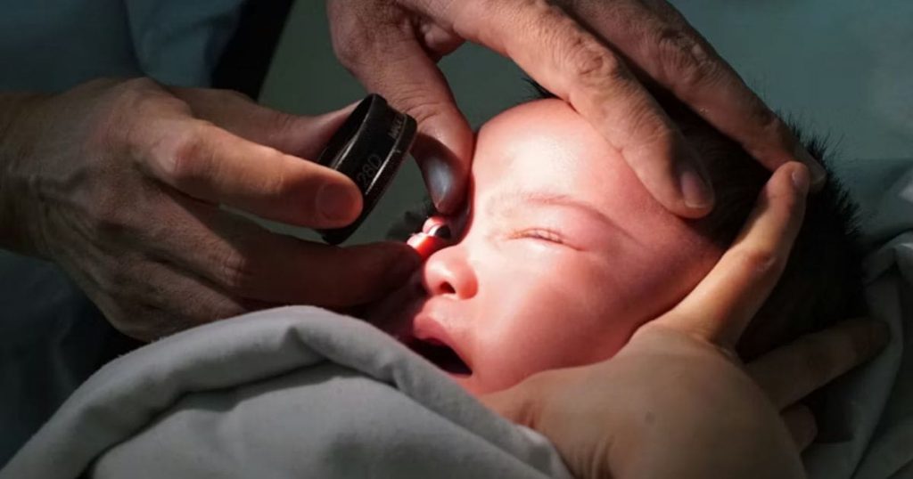 Một số em bé sinh non không may mắc bệnh võng mạc từ khi mới ra đời