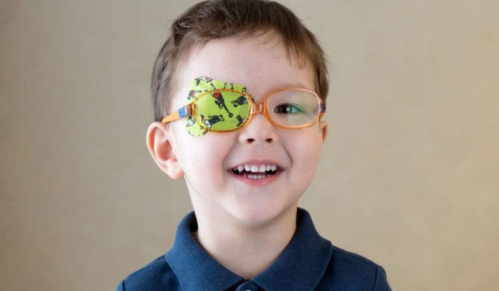 Nhược thị do cận thị nặng khiến thị lực suy giảm, não không nhận đủ tín hiệu từ mắt