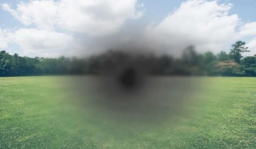 Thoái hóa hoàng điểm ở người cận thị nặng, tổn thương điểm vàng, mất khả năng nhìn chi tiết