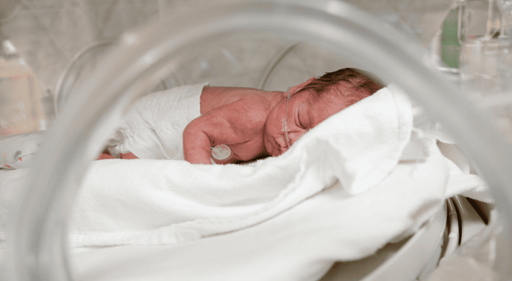 Bệnh võng mạc trẻ đẻ non là nguyên nhân dẫn đến tình trạng xuất huyết võng mạc ở trẻ sơ sinh