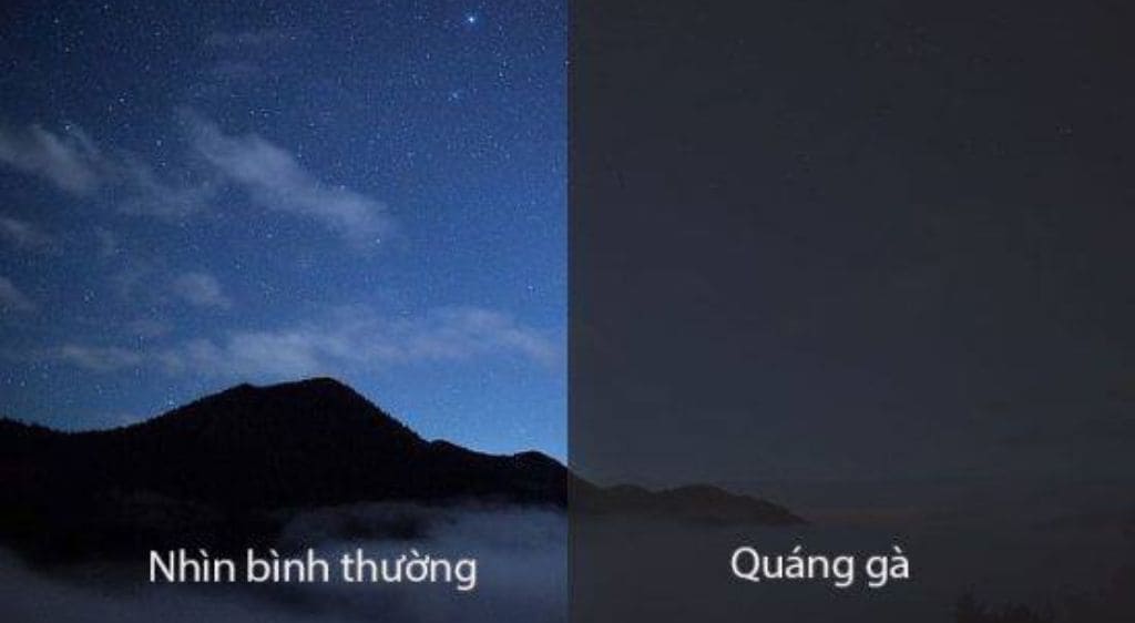 Sự khác biệt của người bình thường và người bị quáng gà