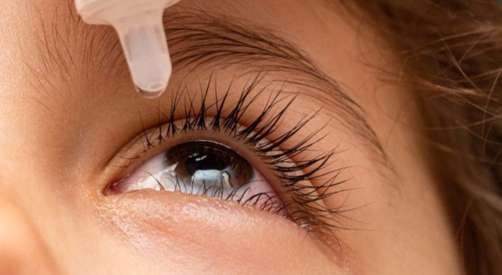 Vệ sinh mắt cẩn thận sau khi phẫu thuật 24 giờ