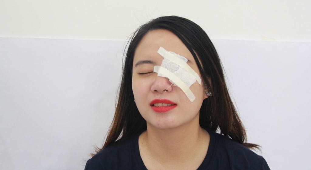 Bác sĩ có thể băng mắt để giúp hạn chế cử động để tổn thương mau lành hơn