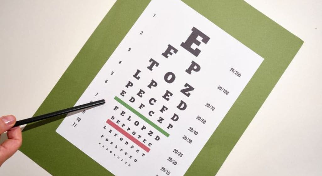 Bác sĩ sẽ sử dụng bảng Snellen để giúp đánh giá sức khỏe thị lực của bạn