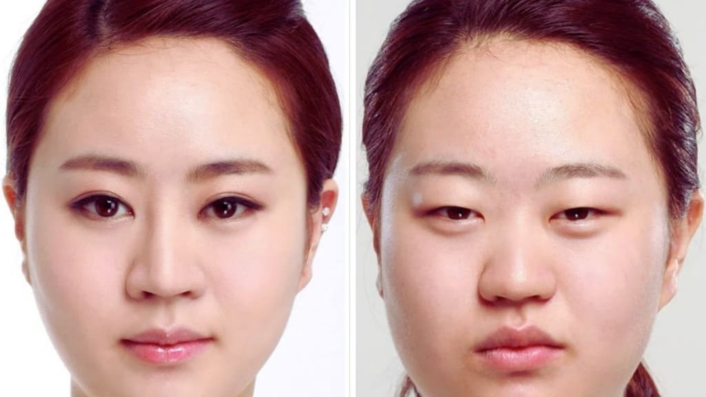 Cắt mí Baby đang là kỹ thuật tạo hình thẩm mỹ mắt được ưa chuộng ở mọi lứa tuổi