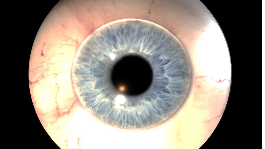 Dịch kính là một khối gel trong suốt trong nhãn cầu