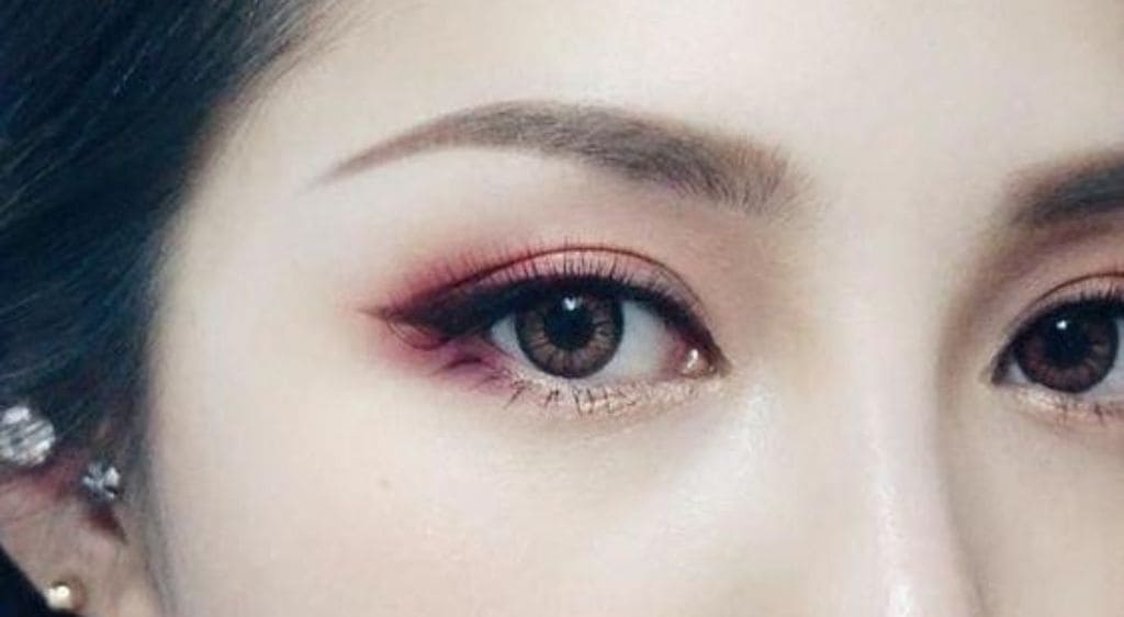 Đôi mắt 2 mí to tròn, nếp mí rõ nét giúp gương mặt trẻ trung hơn