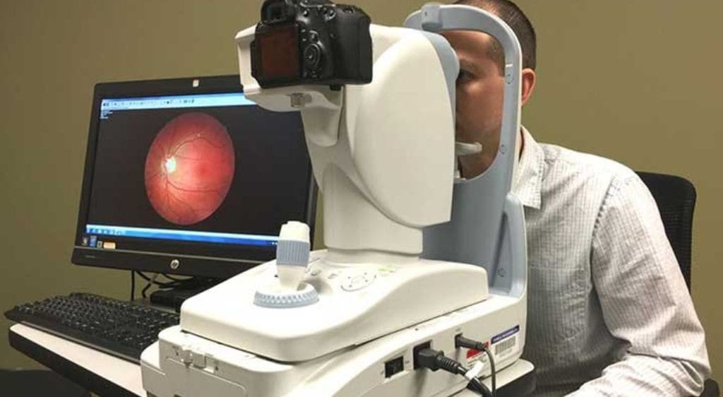 Phương pháp chụp cắt lớp võng mạc OCT hiện đại, không xâm lấn