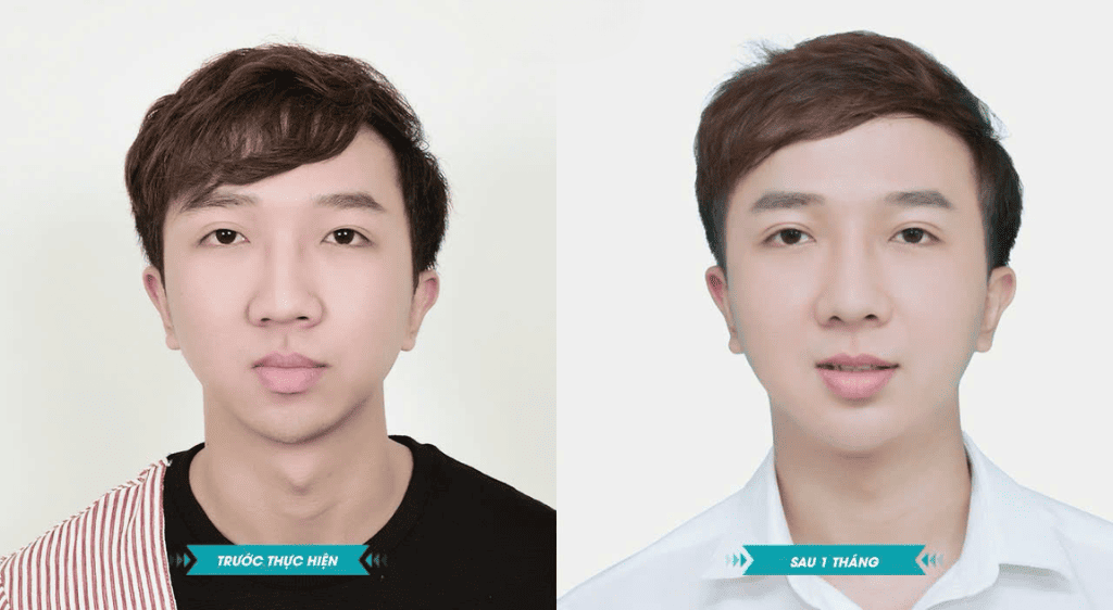 Tái khám định kỳ giúp bác sĩ theo dõi và kịp thời giải quyết mọi vấn đề phát sinh