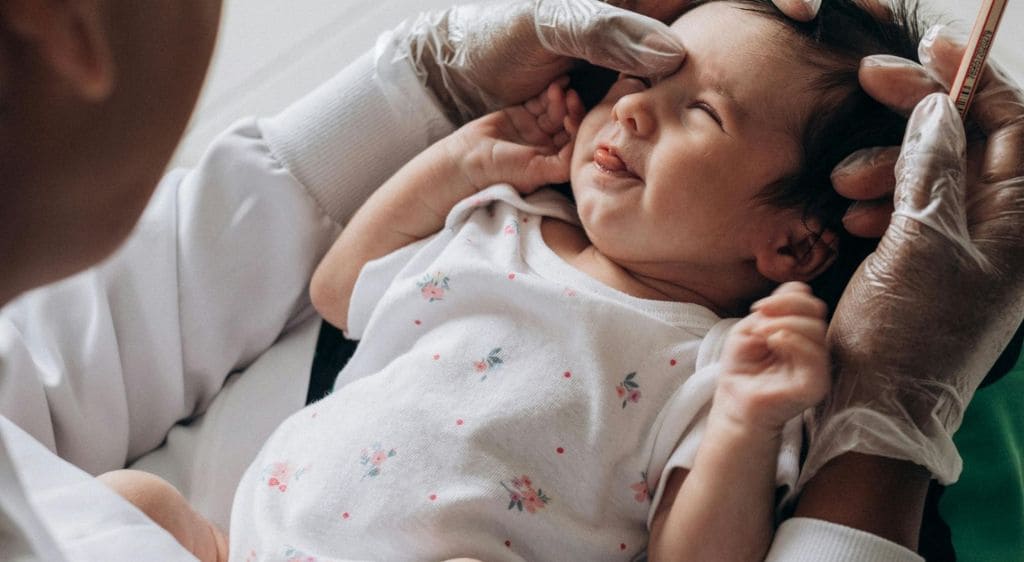 Trẻ sơ sinh có tia máu trong mắt do áp lực trong quá trình sinh nở