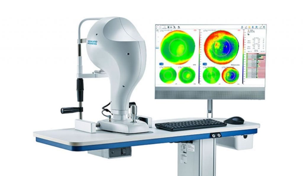 Bản đồ giác mạc 3D sắc nét được tái tạo bởi công nghệ Schwind Sirius