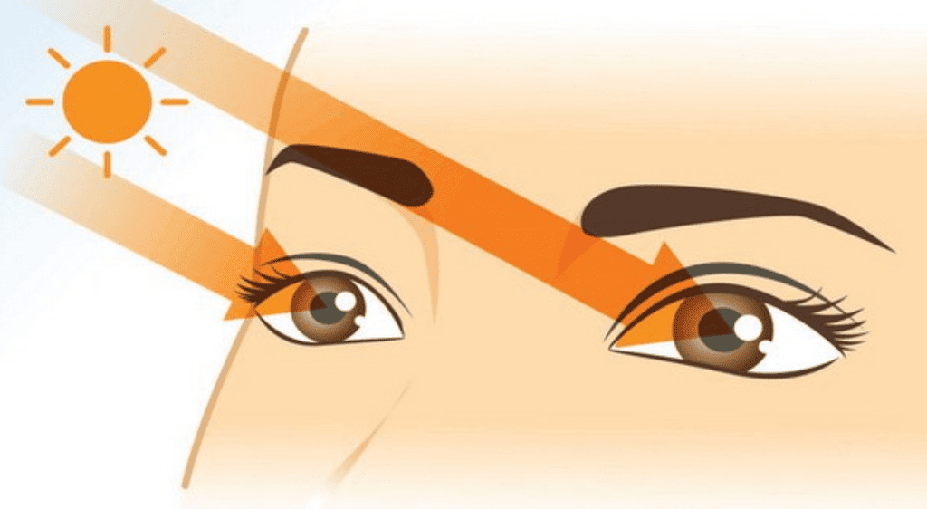 Bảo vệ mắt khỏi bụi bẩn và ánh sáng giúp quá trình hồi phục nhanh và hiệu quả hơn