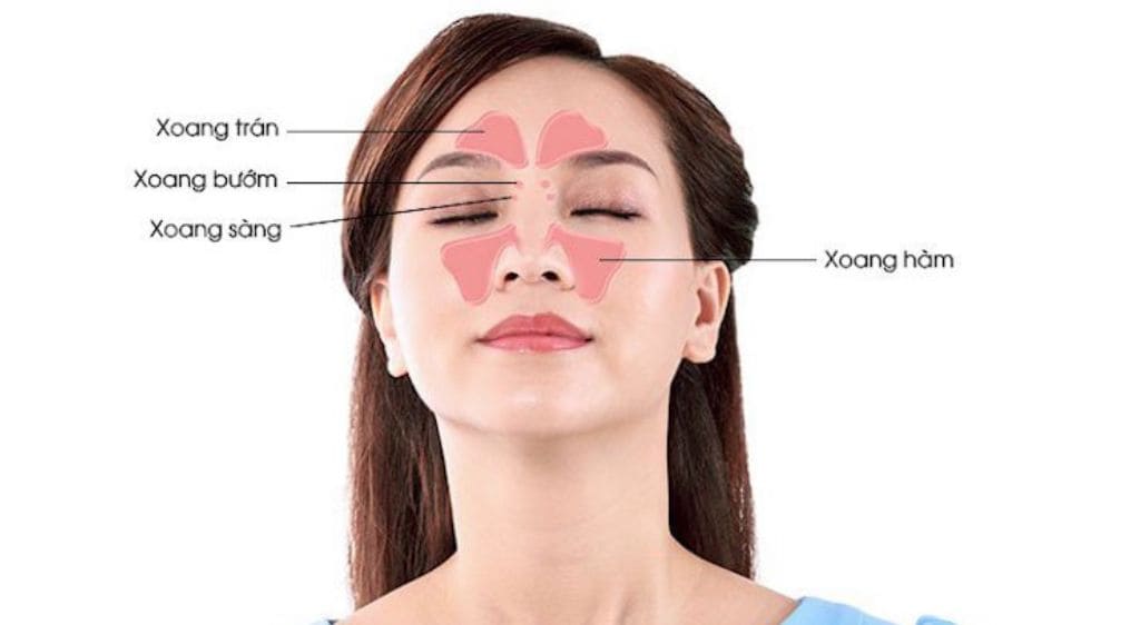 Biến chứng viêm xoang chính là nguyên nhân phổ biến nhất gây ra viêm hốc mắt